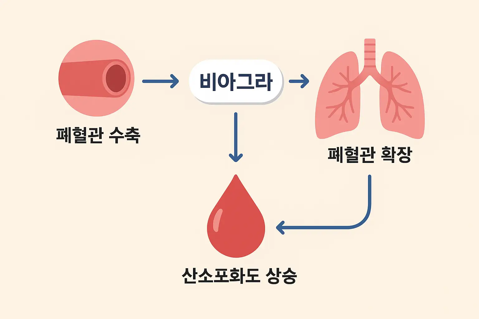 비아그라 고산병 치료·예방 완벽 가이드【2025 최신판】